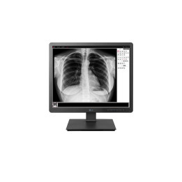 LG 19HK312C monitor de ecrã 48,3 cm (19") 1280 x 1024 pixels SXGA LED Preto